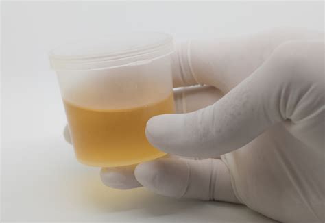 urine drug test any impact due to vitamin tablets|drug detection in urine.